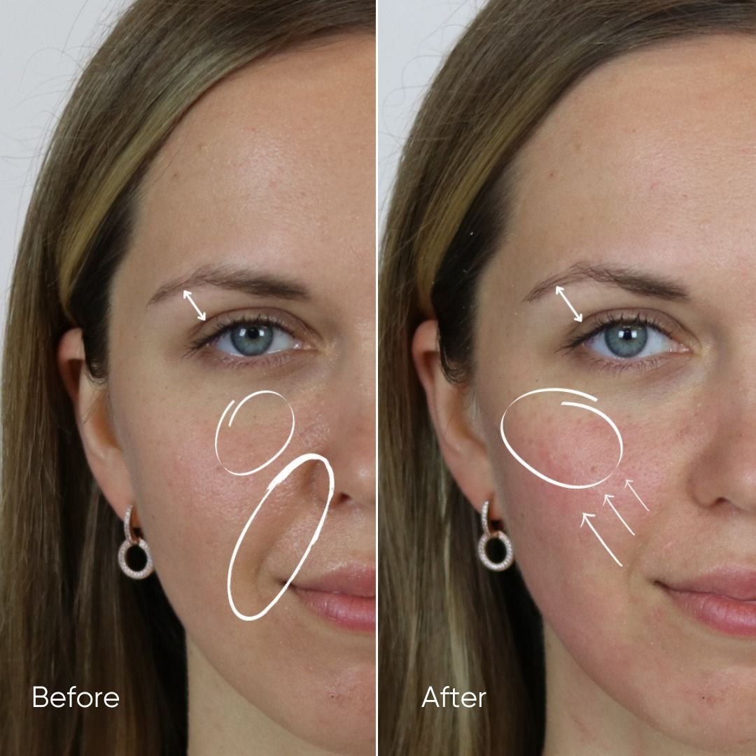 Zemits HydroVerstand PRO 7-in-1 HydroDiamond™ System