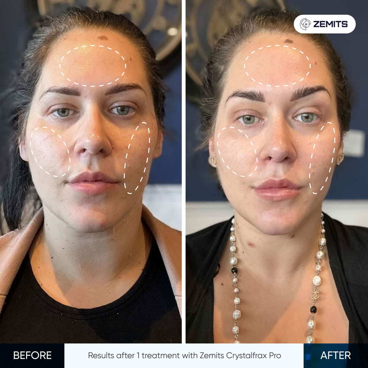 Before After Slide 3