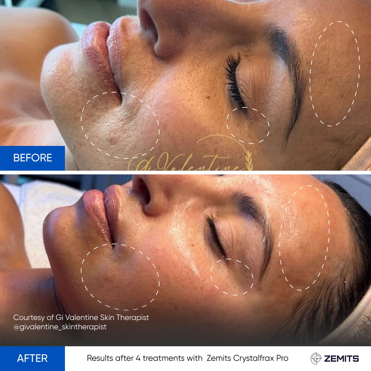 Before After Slide 5