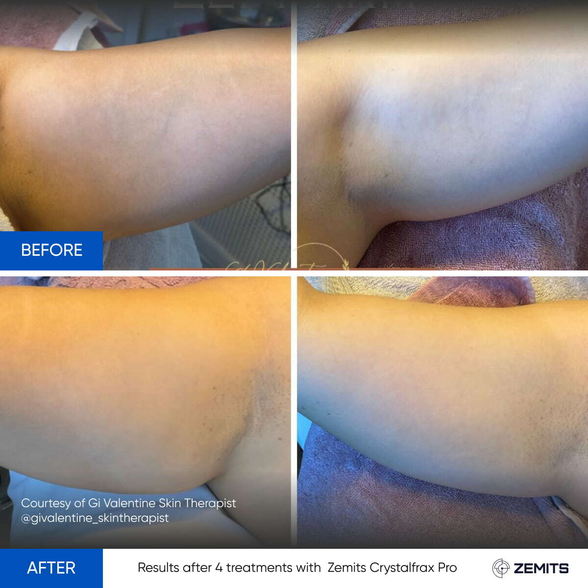 Before After Slide 8