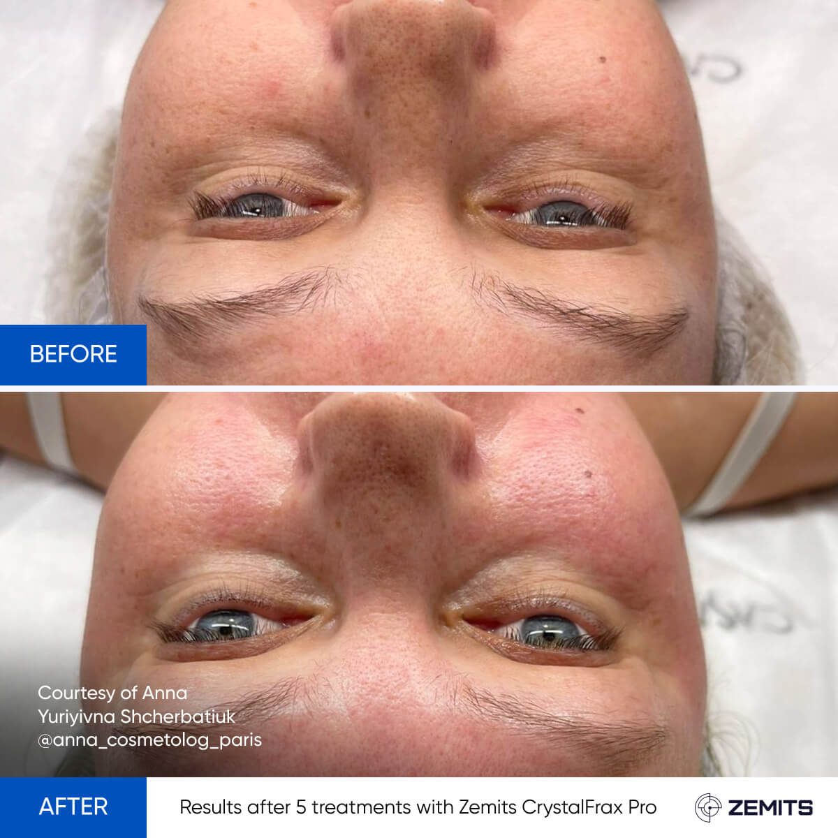 Before After Slide 13