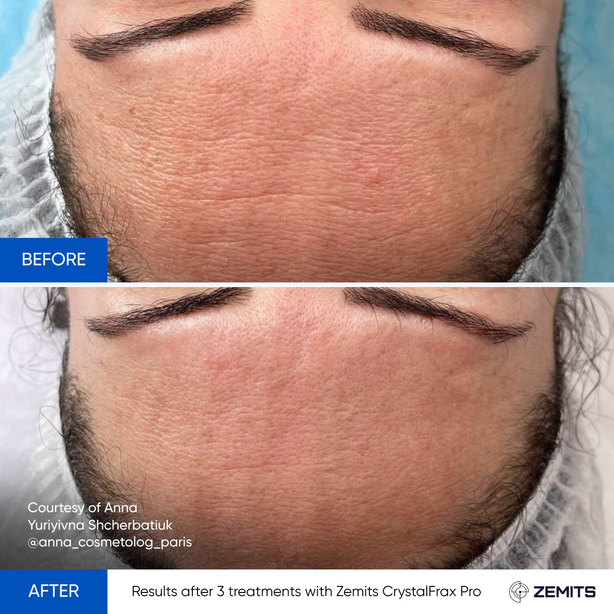 Before After Slide 15