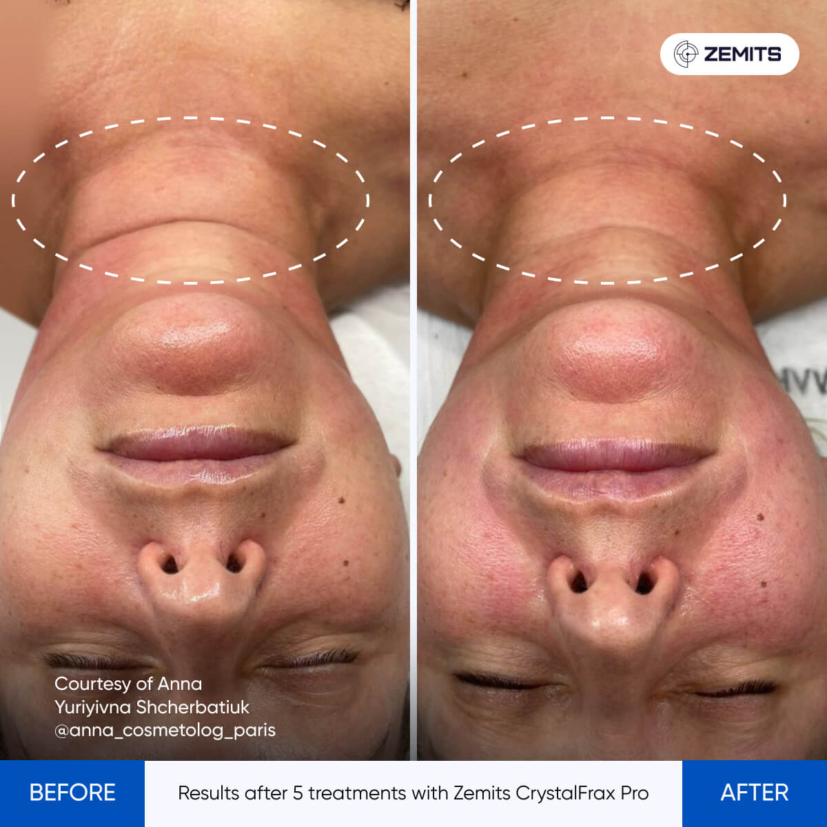 Before After Slide 20
