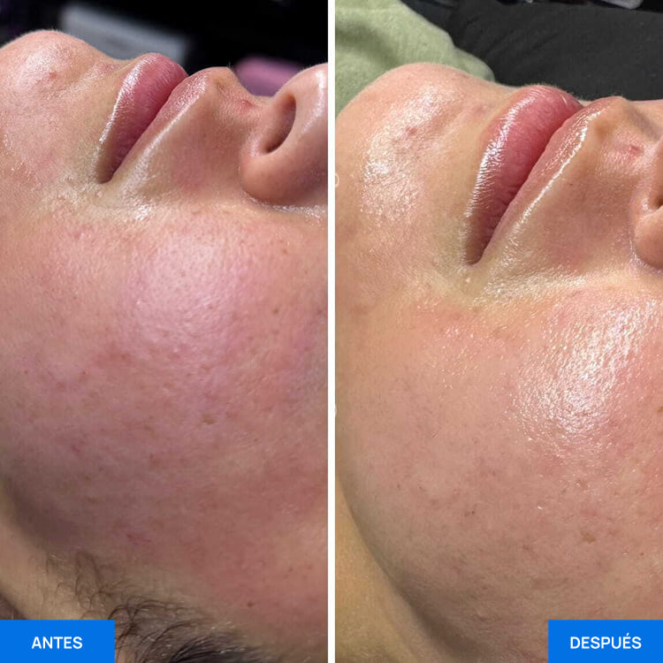 Zemits OxiVelour Pro