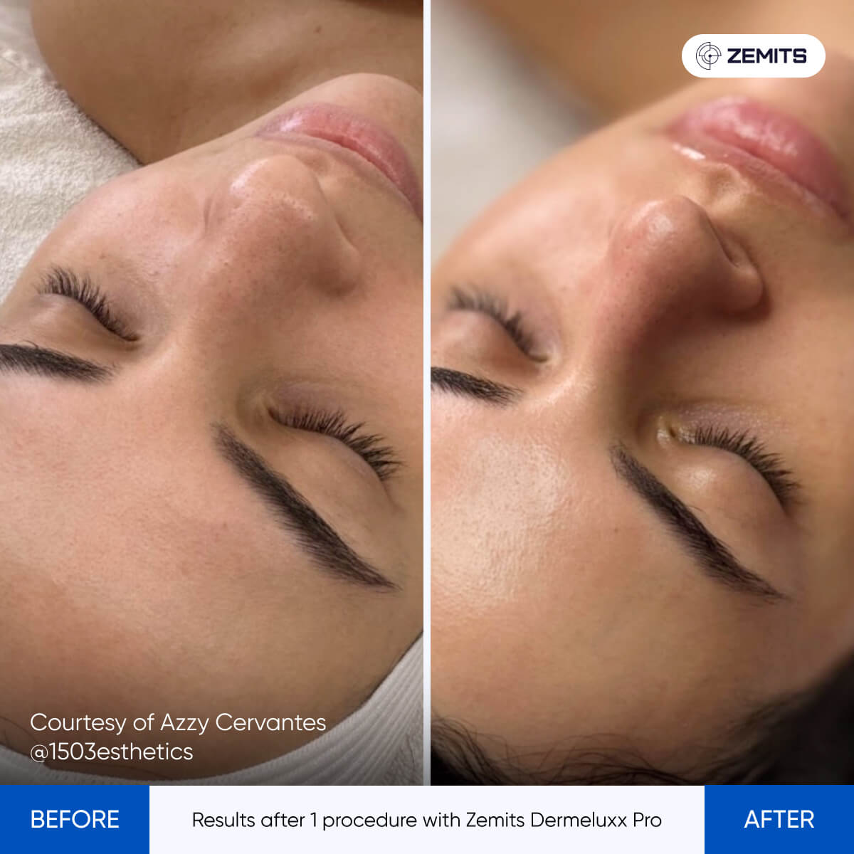 Before After Slide 6