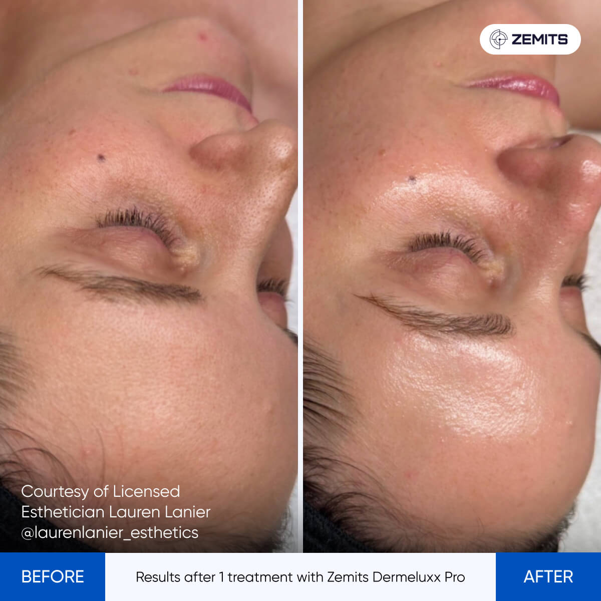 Before After Slide 19