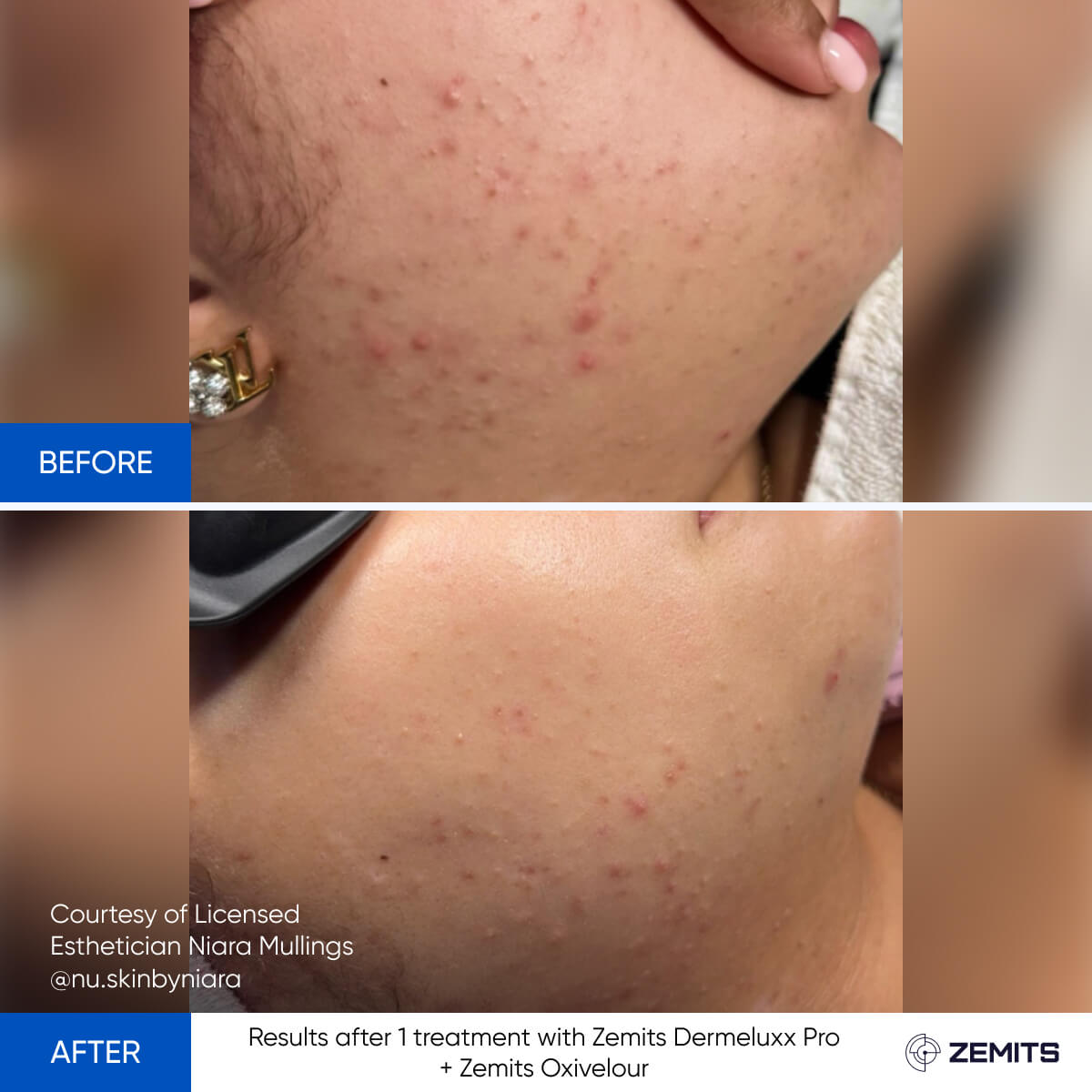 Before After Slide 15