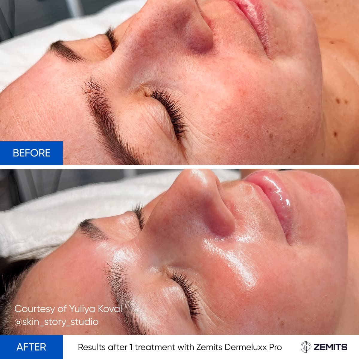Before After Slide 1