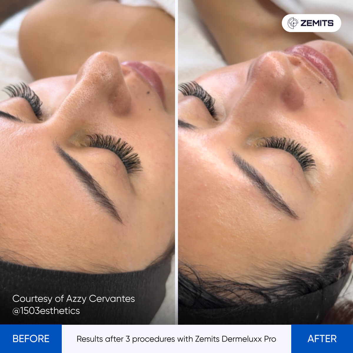 Before After Slide 7