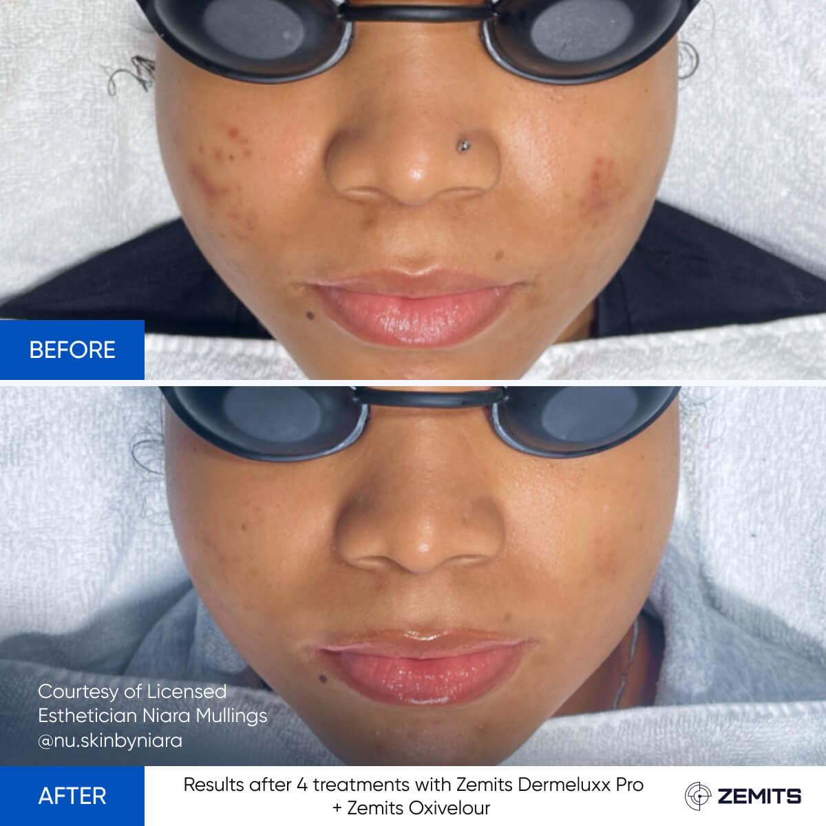 Before After Slide 13