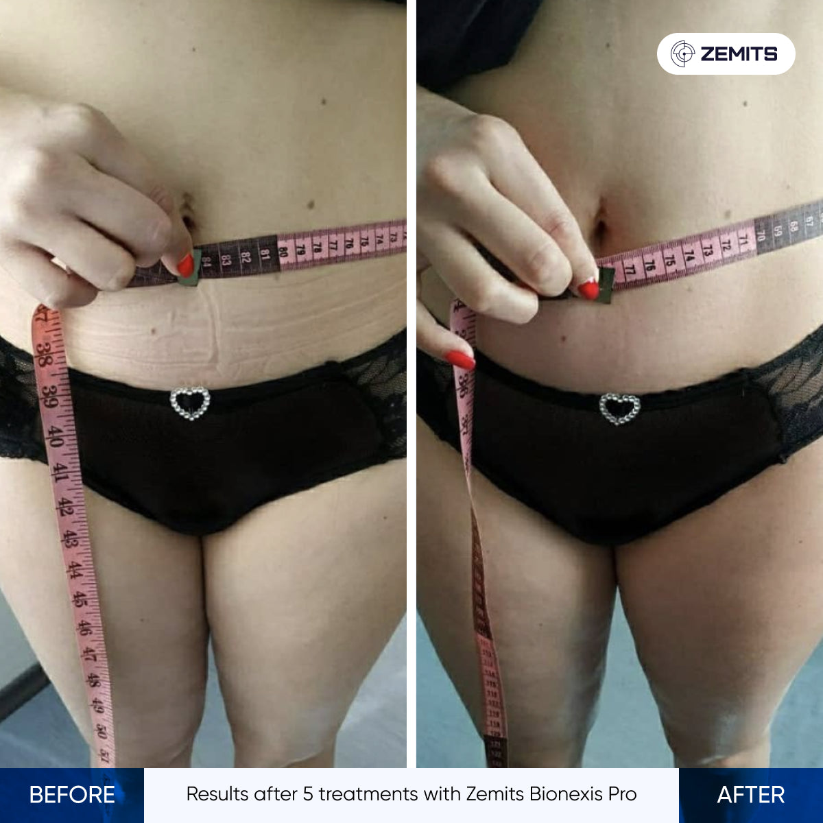 Before After Slide 5