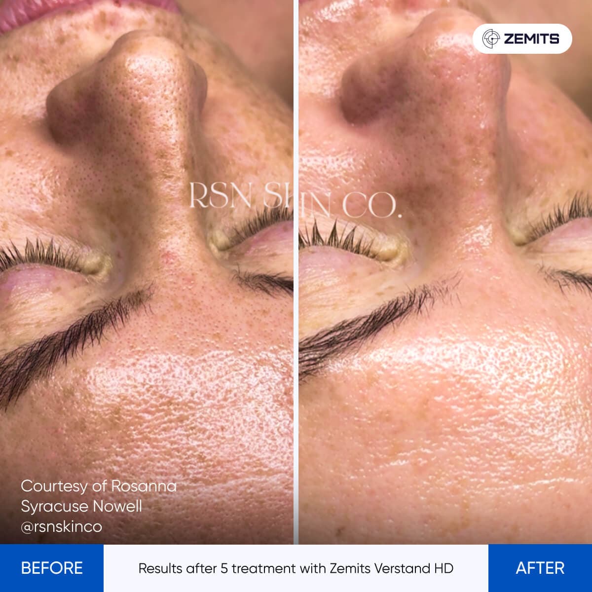 Before After Slide 8
