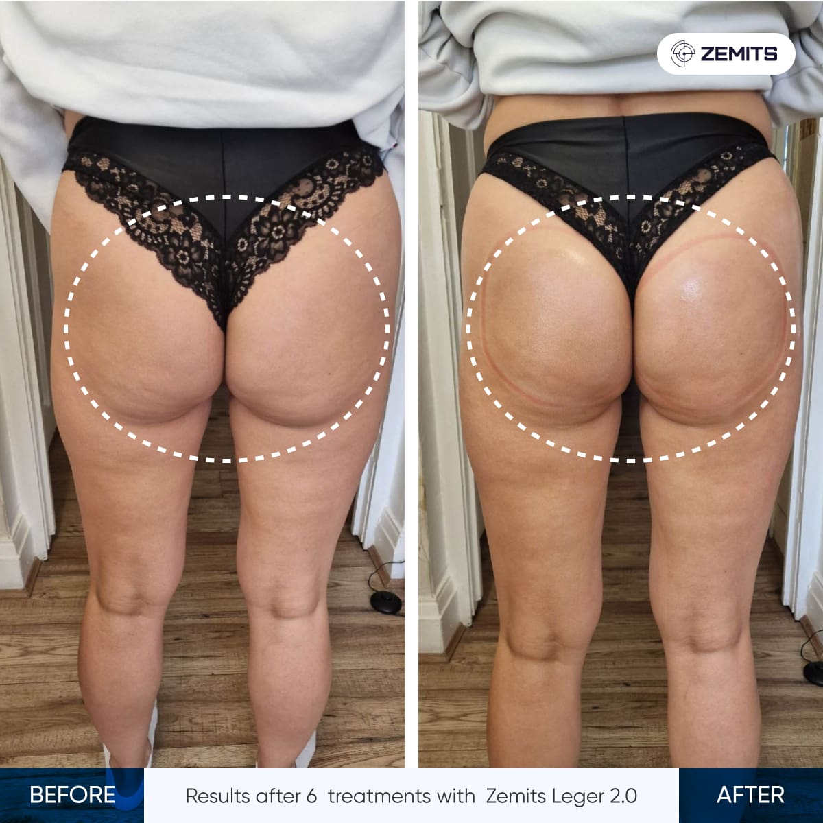 Before After Slide 1