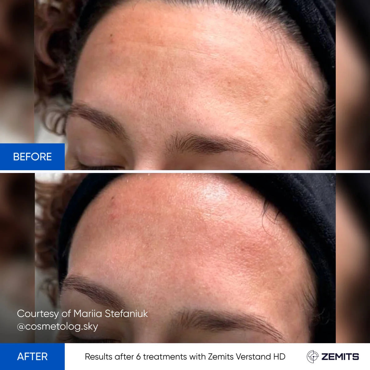 Before After Slide 3