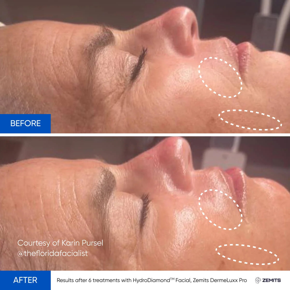 Before After Slide 3
