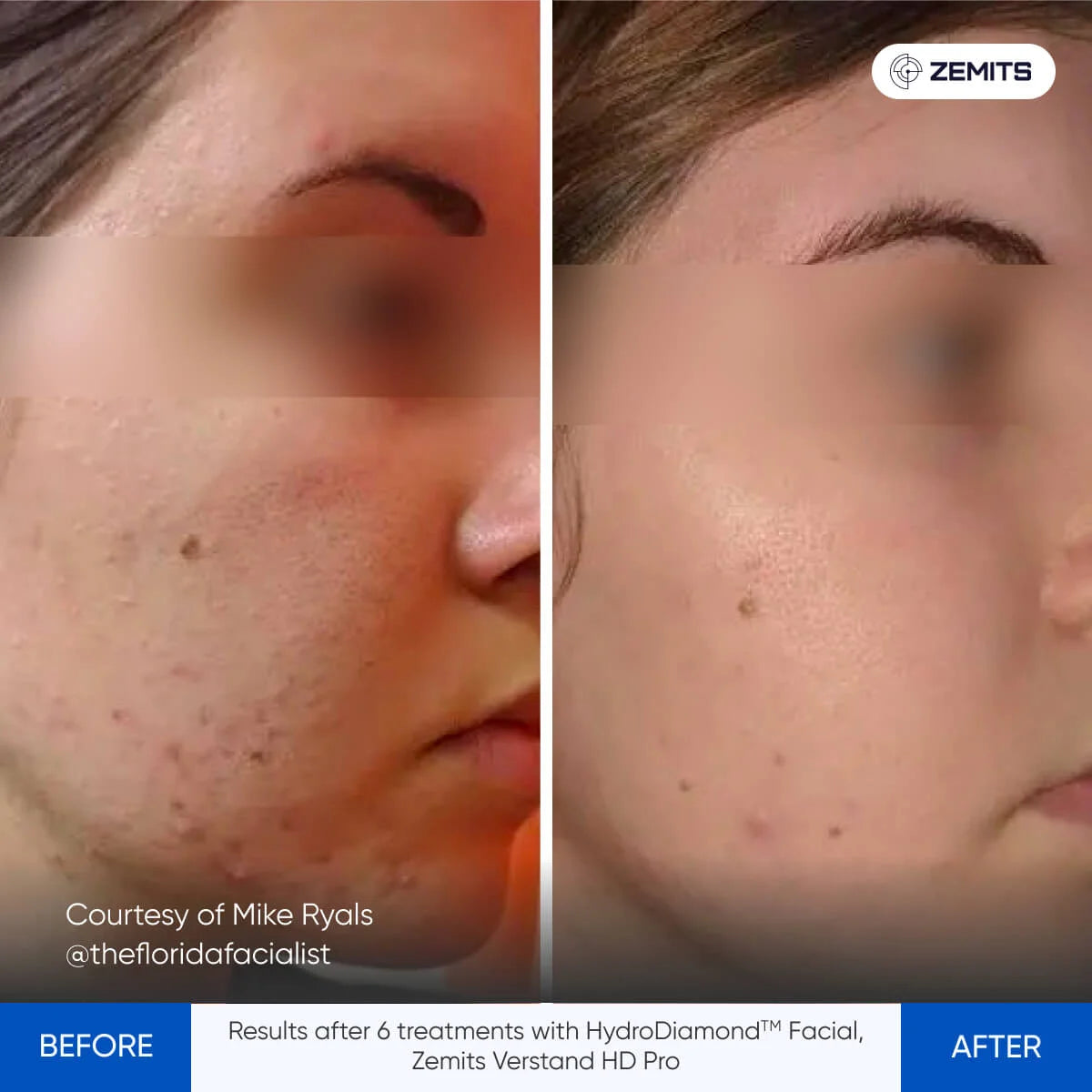 Before After Slide 5