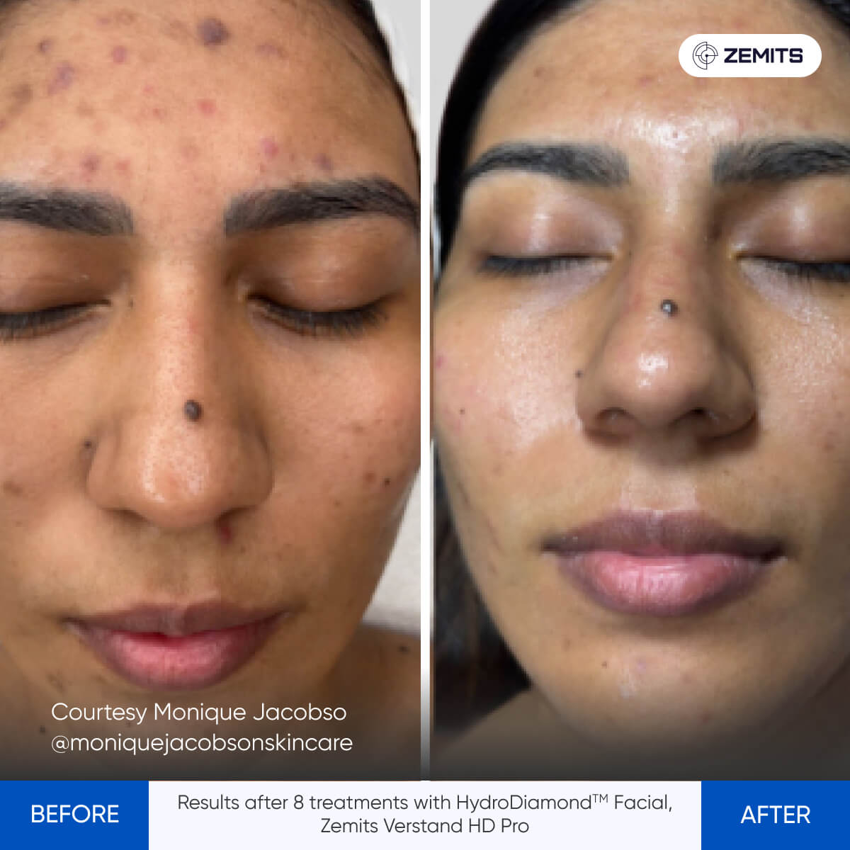 Before After Slide 2