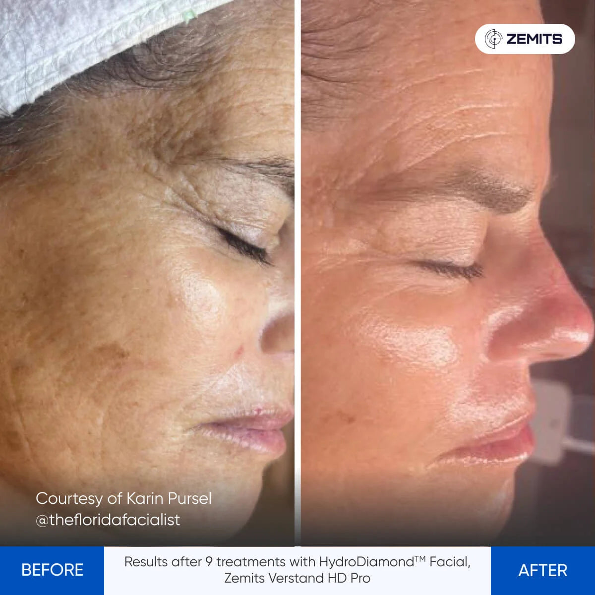 Before After Slide 6