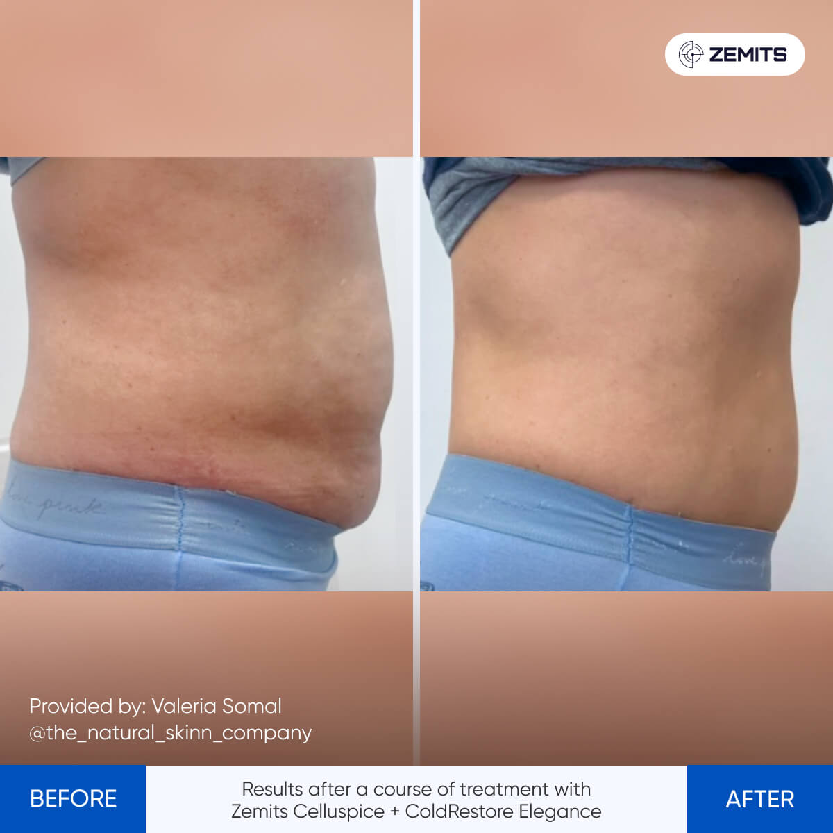 Before After Slide 2