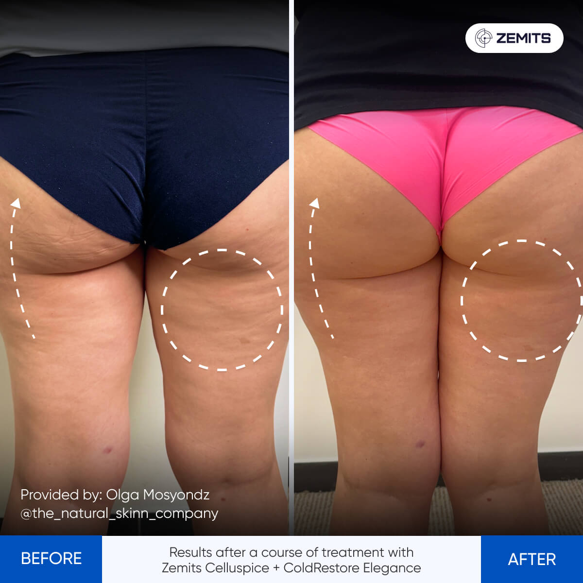 Before After Slide 3