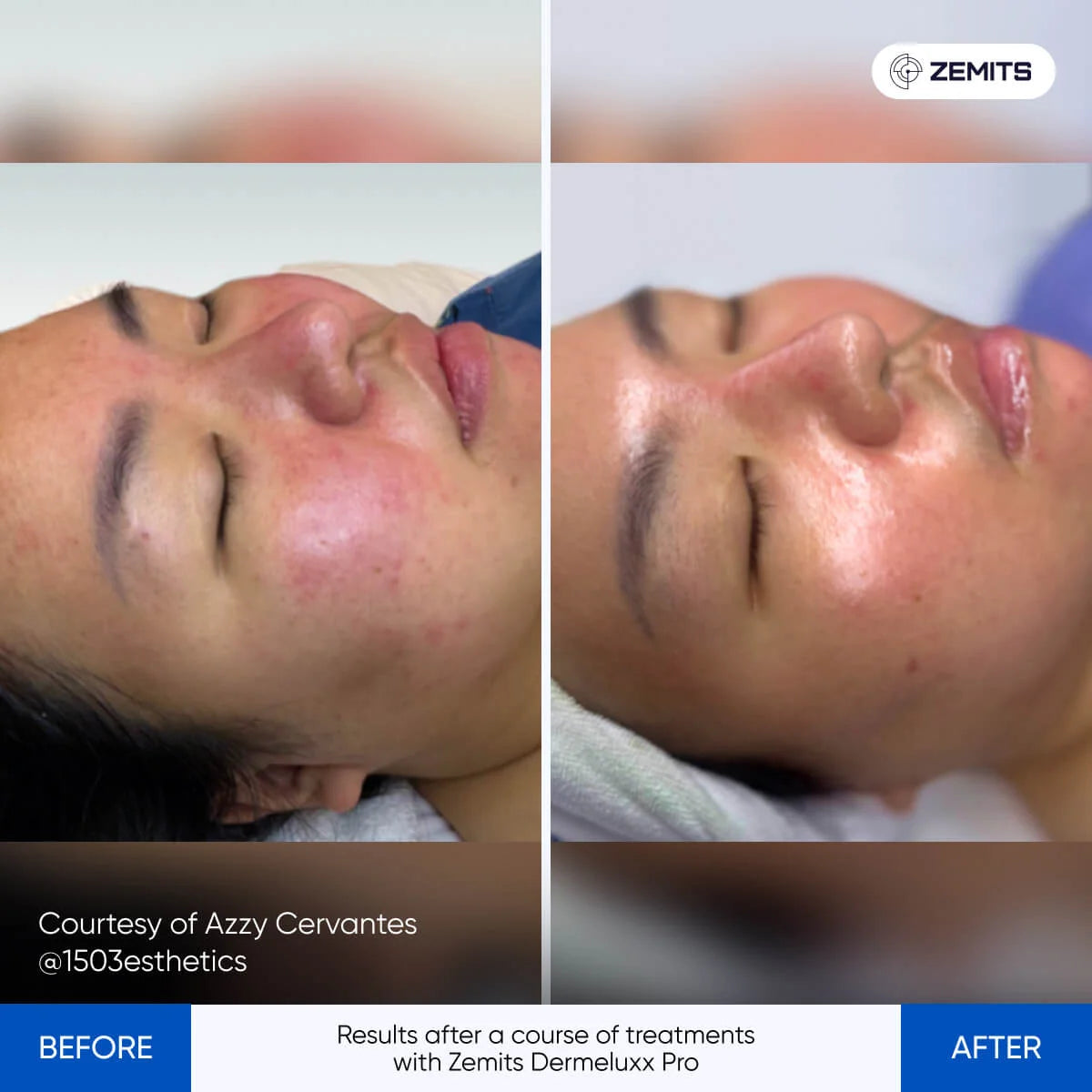 Before After Slide 9
