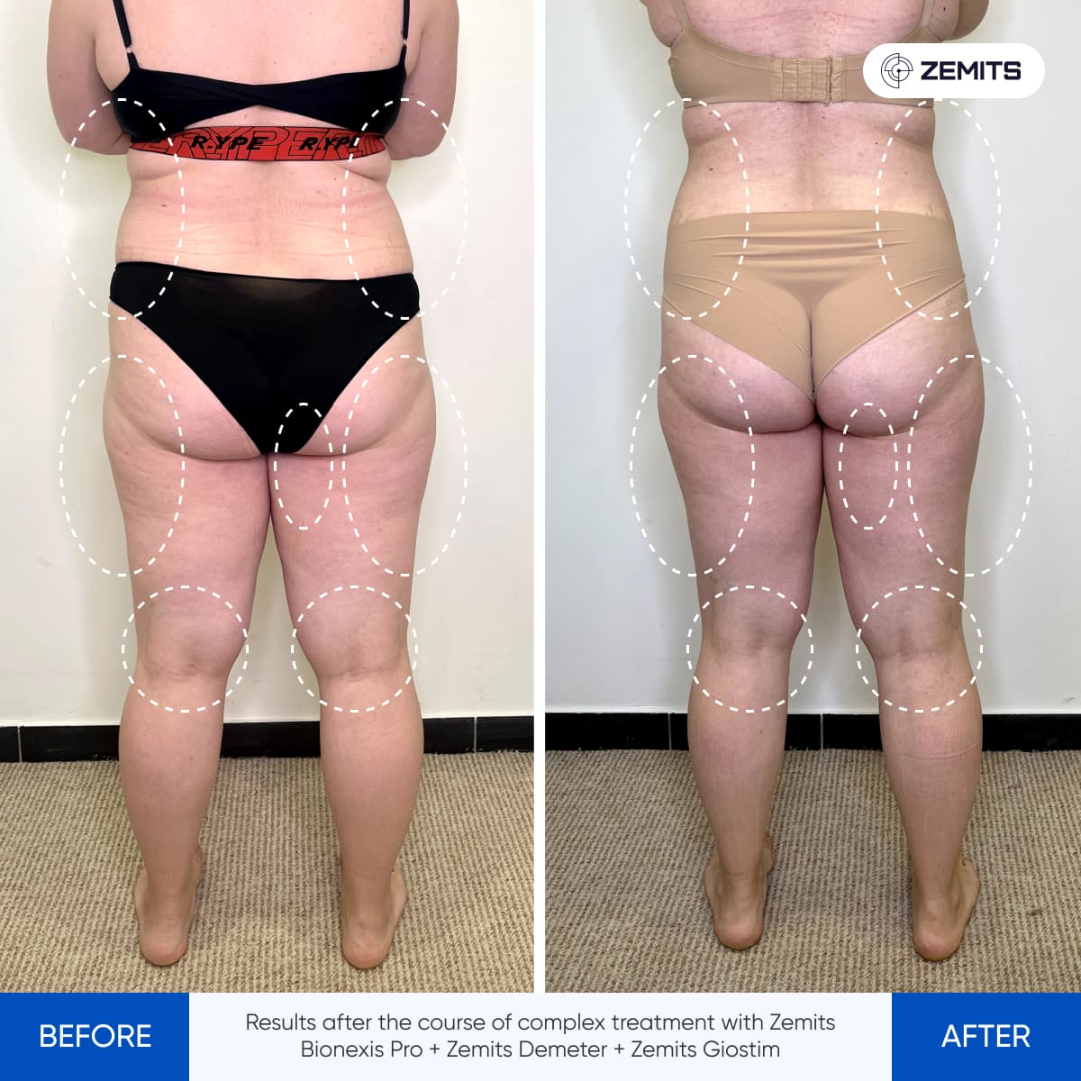 Before After Slide 9
