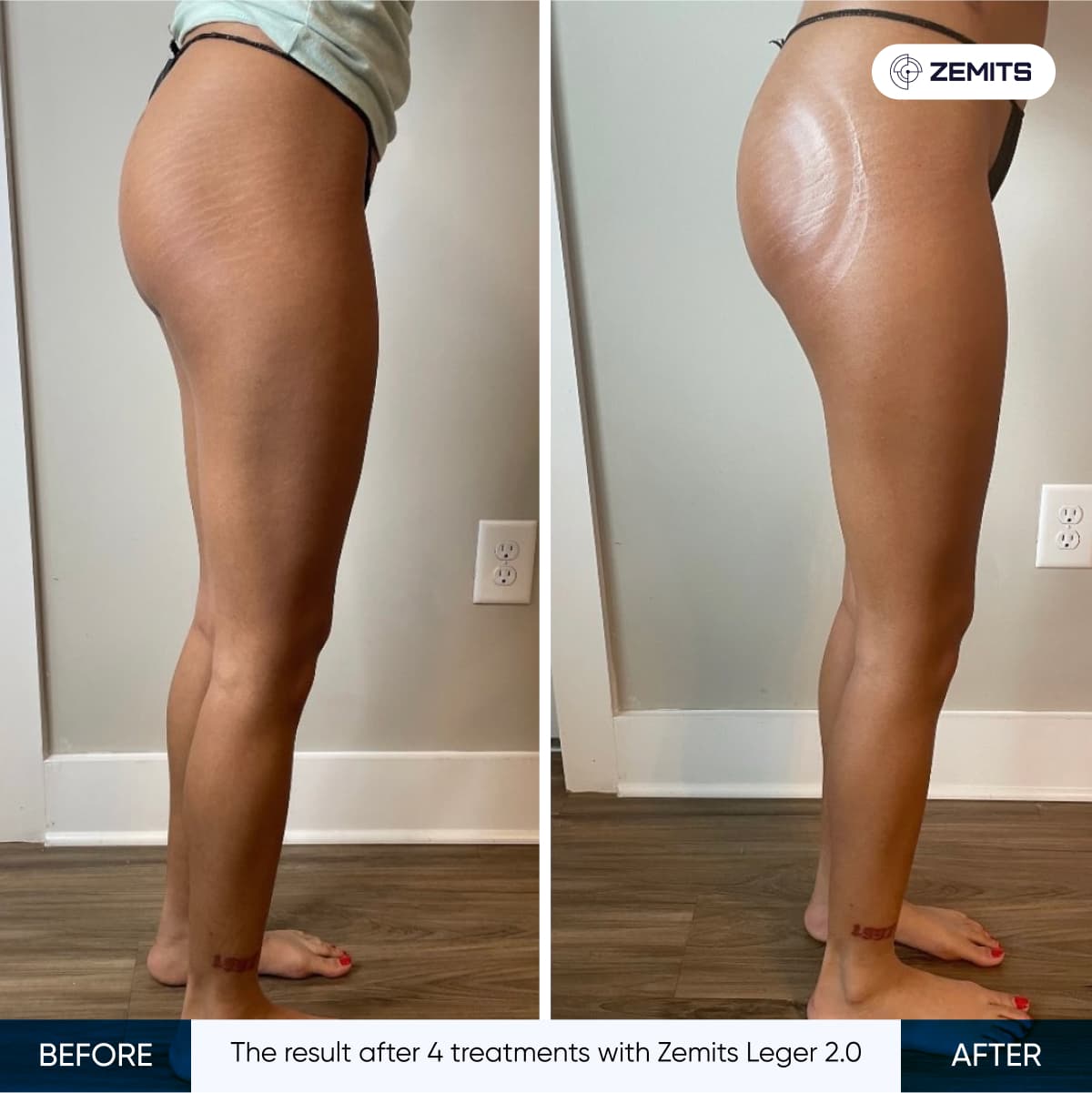 Before After Slide 7