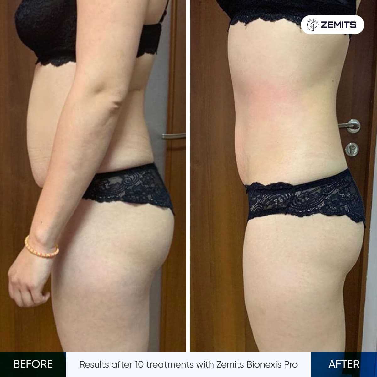 Before After Slide 3