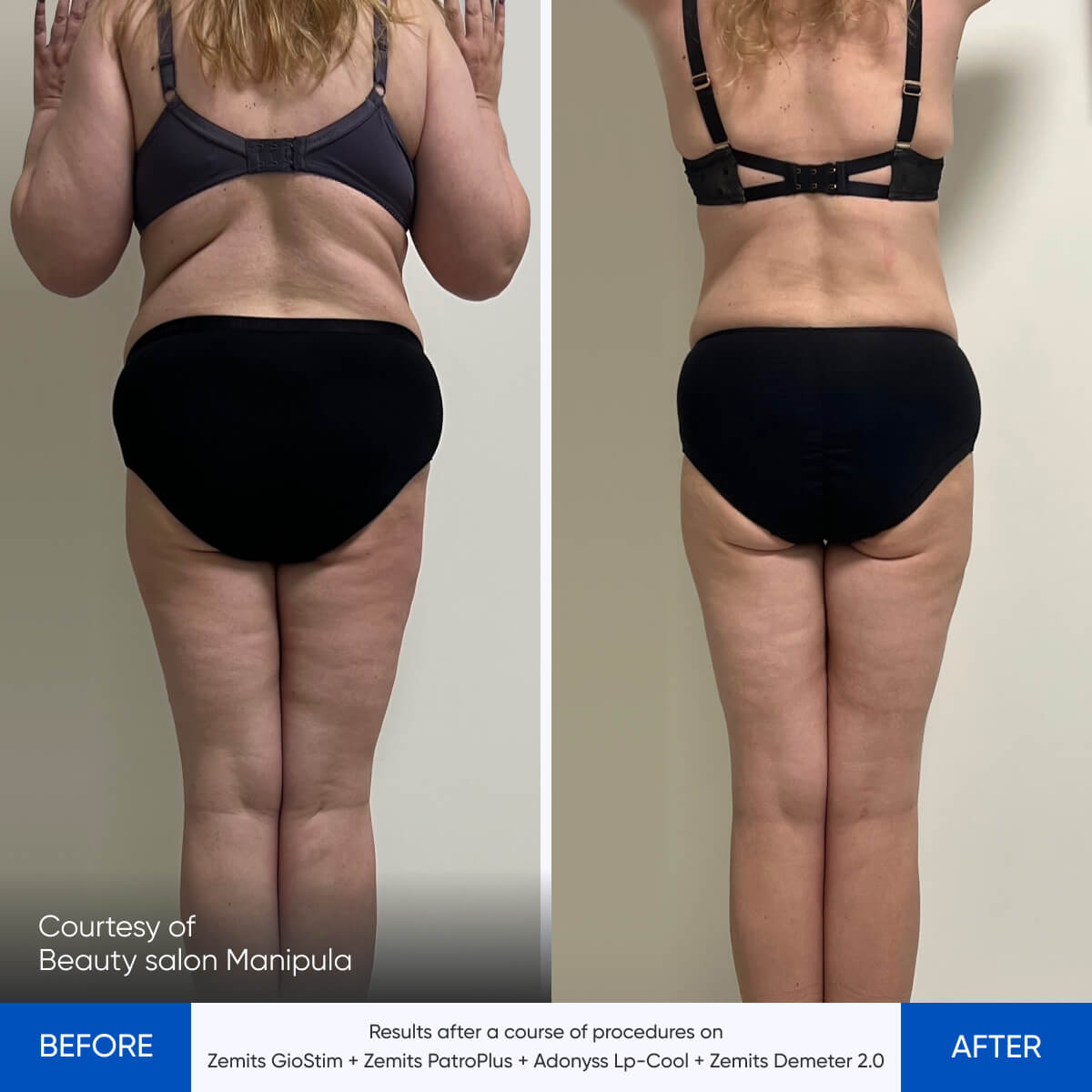 Before After Slide 1