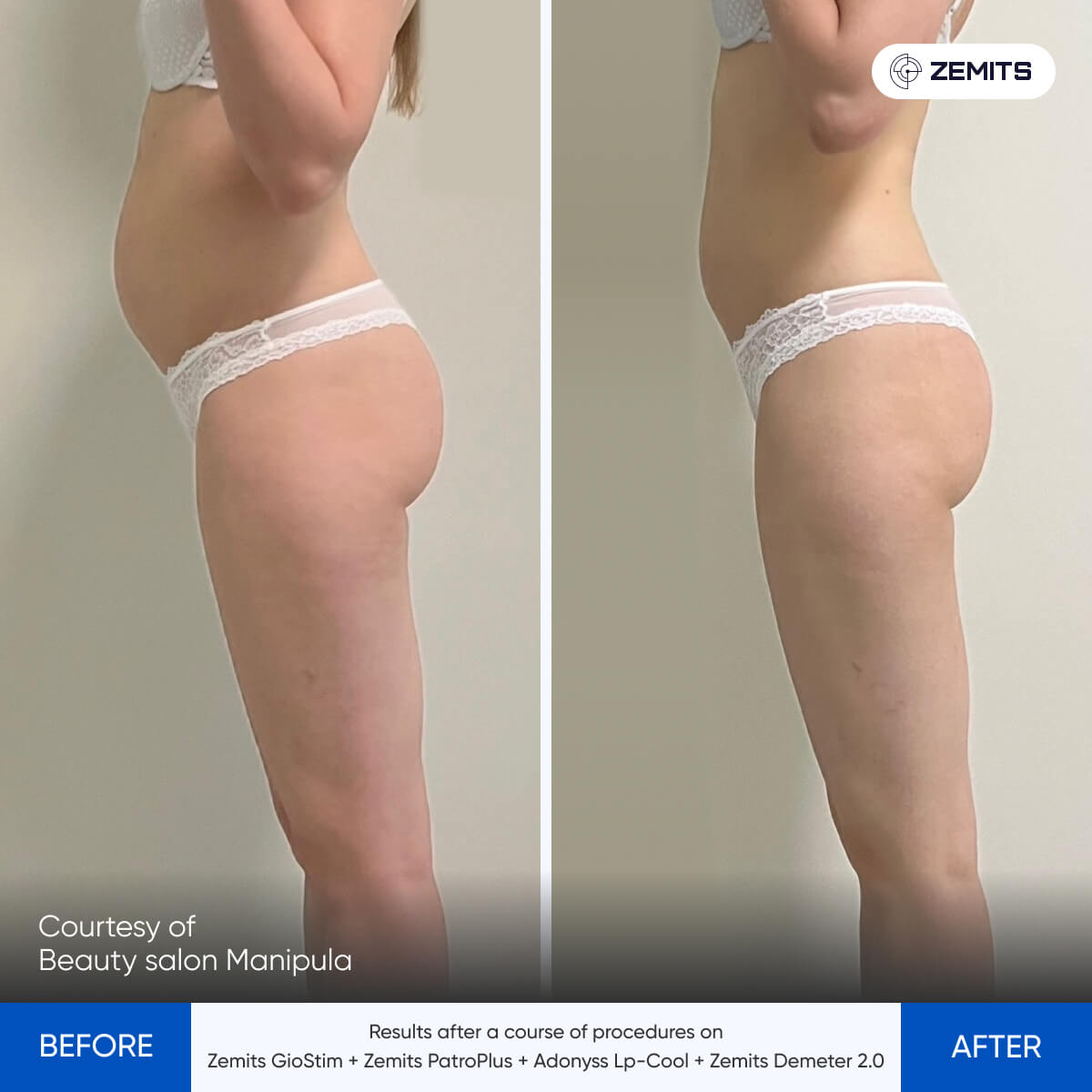 Before After Slide 2