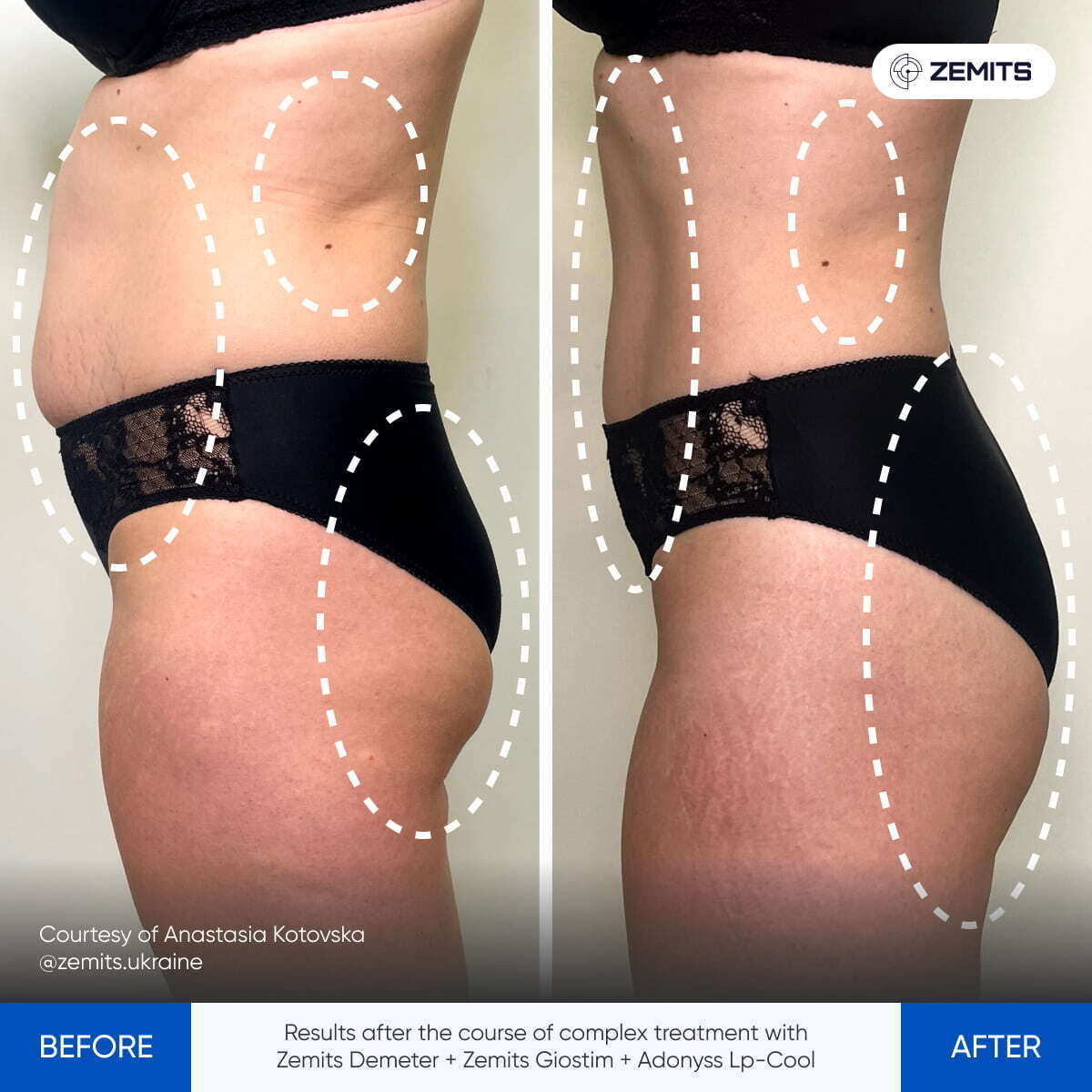 Before After Slide 5