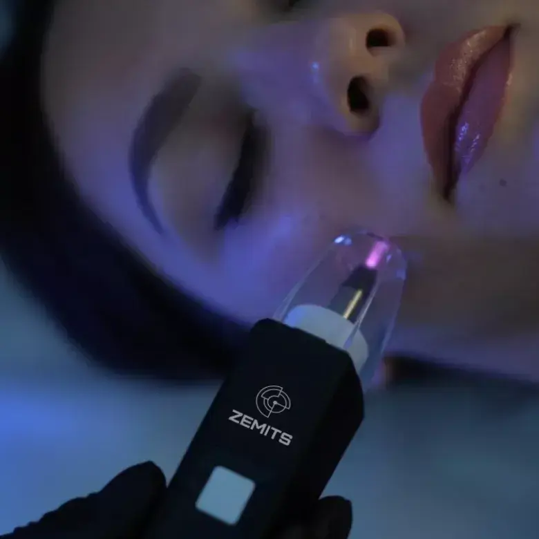 Cold Plasma Treatment with Zemits EvoPlasm