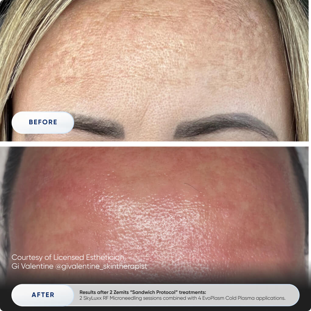 Before After Slide 3