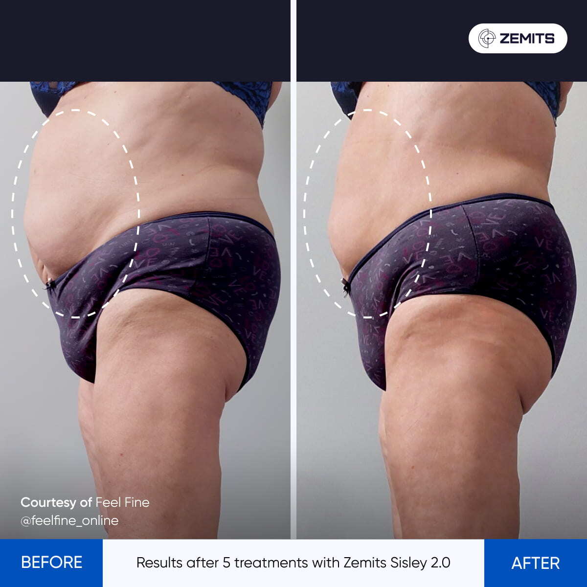 Before After Slide 1