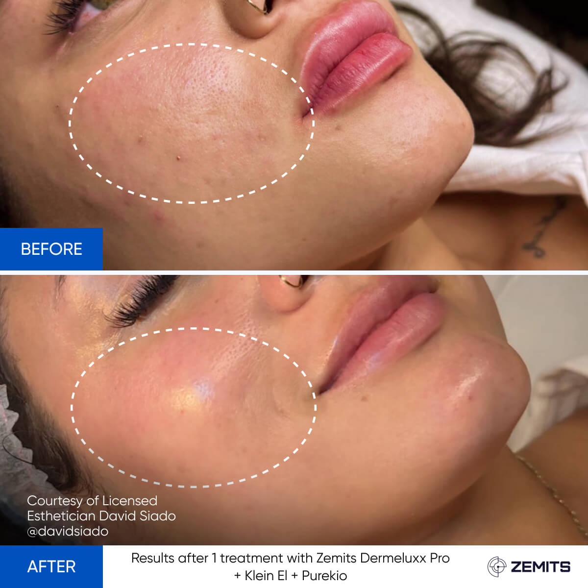 Before After Slide 6