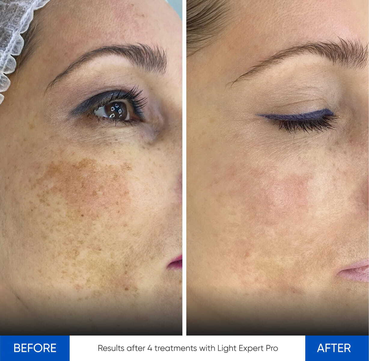 Before After Slide 5