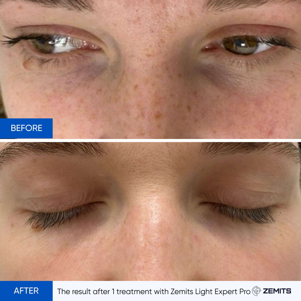 Before After Slide 6