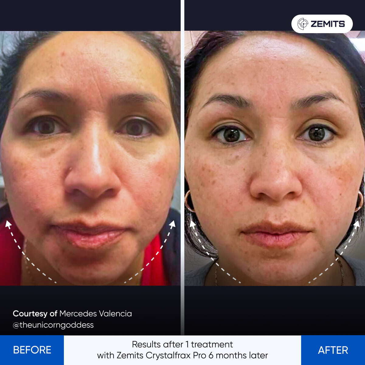 Before After Slide 2