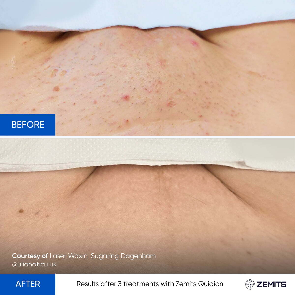 Before After Slide 2