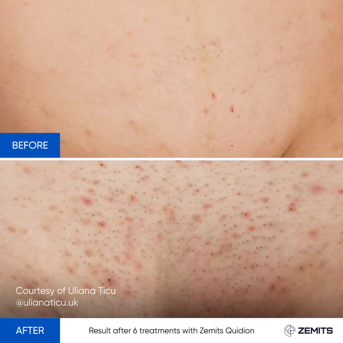 Before After Slide 4